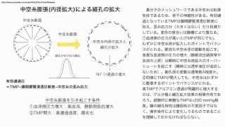 高圧濾過(高TMP)濾過でｱﾙﾌﾞﾐﾝﾘｰｸを増大させる5つのﾒｶﾆｽﾞﾑ(その1)