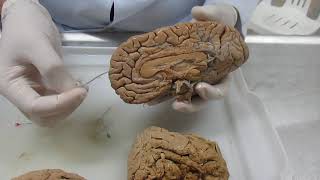 Morfologia Externa do Telencéfalo