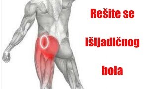 Rešenje za bol u leđima koji se spušta niz jednu nogu
