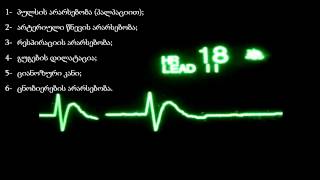 ეკგ მონიტორი 4/ გულის აგონური რითმი (მომაკვდავი გულის რითმი) / სიკვდილის წინა პერიოდი / ემერჯენსი
