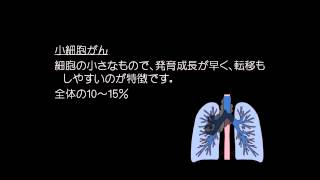 肺がん　大和徳洲会病院