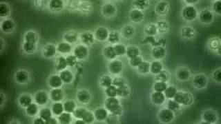 What are Viruses ?