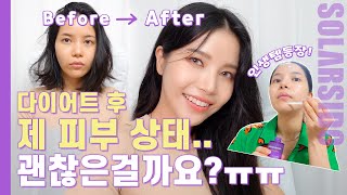 다이어트가 피부에 주는 영향?! 이렇게 해결하세요.