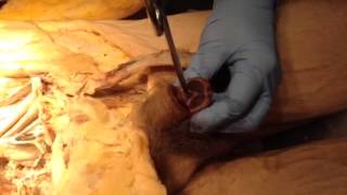 Male genitalia dissection