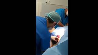 parto vaginal primeriza sin corte, sin desgarro. Papa corta cordón umbilical.