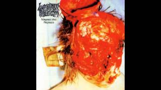 Lymphatic Phlegm - Pathogenesis Infest Phlegmsepsia FULL ALBUM (2002 - Pathological Goregrind)