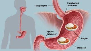 Chinese food stomach endoscopy