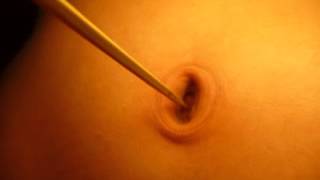 my belly button