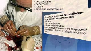 Хирургическое лечение болезни Крона