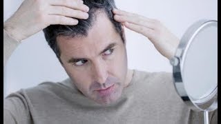 علاج الشيب عند الرجال