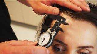 Пересадка ВОЛОС и средства от выпадения. Ответы ВЕНГЕРСКОГО врача