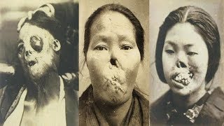Fascinating Early Medical Oddities