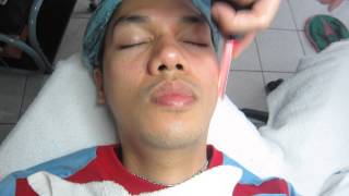 Facial w/ Diamond Peel & Non-Surgical Face Lift Treatment Part 5/7