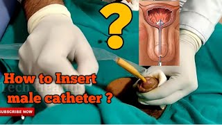 Male Catheter insertion Procedure in Hindi ||Foley catheter insertion trick | how to insert catheter
