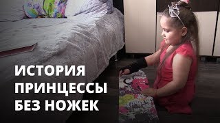 Принцесса без ножек. Как живет девочка, которая попала под трамвай