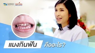 แมงกินฟัน คืออะไร  | Digital Dental Center
