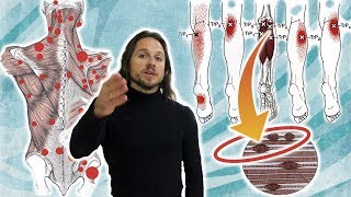 Что такое миофасциальный синдром, ? триггерные точки в мышцах и миофасциальный релиз ⭐ SLAVYOGA
