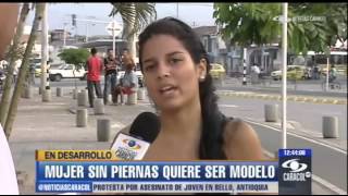 Amputada Bilateral quiere ser modelo (2) /Bilateral Amputee wants to be Runway Model (2)