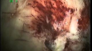 язва желудка у кошки \ stomach ulcers in cat