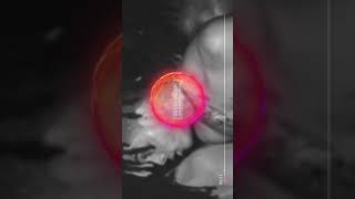 XXXTentacion-Jocelyn Flores (8D audio ) ?