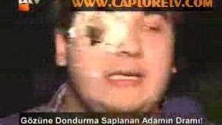 şahan dondurma saplanan adam
