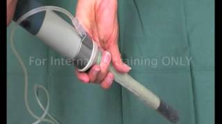 Endorectal Examination transducer collar installation procedure