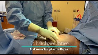 Abdominoplasty - Dr. Michael Jones | Lexington Plastic Surgeons