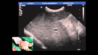 Normal Scanning: Stomach