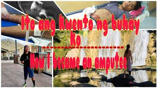 Ang kwento ng buhay ko / How I became an amputee / prosthetic leg below the knee