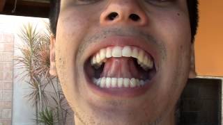 Aprenda Beatbox - A Caixa Keh (detalhadamente)