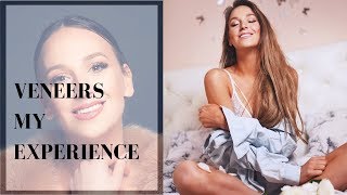 ВСЯ ПРАВДА О ВИНИРАХ/ЦЕНА/ ПОСЛЕДСТВИЯ/ РЕЗУЛЬТАТ - Veneers Identalia