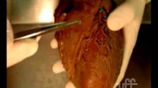 Anatomia coração parte 1