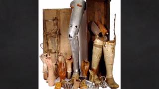 Prosthetic History