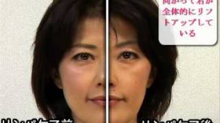リンパケアの小顔＆リフトアップ　顔半分比較