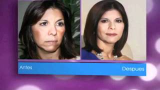Tratamiento para quitar las manchas de la cara-Testimonios y casos reales Conffianz