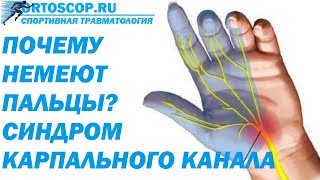 СИНДРОМ КАРПАЛЬНОГО КАНАЛА. СДАВЛЕНИЕ СРЕДИННОГО НЕРВА