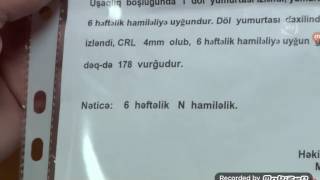 Vicdan haqqi (55 bolum) ANONS