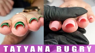 Продолжение Истории СКРУЧЕННЫЕ Ногти/ Татьяна Бугрий