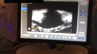 Lower Extremity Reconstruction (Graphic Content)