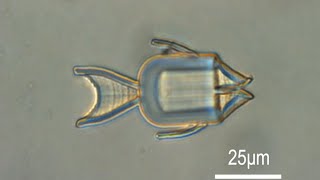 Shape-Morphing Microrobots for Localized Cancer Treatment