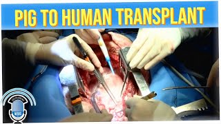 Secret Ingredient Aided Pig-to-Human Heart Transplant (ft. Gilbert Galon)