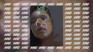 [Bitsu x Oboy Type Beat] HRD - Options