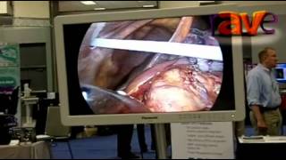 SYNNEX 2012: Panasonic Features Medical-Grade Monitors