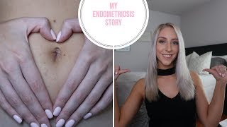 MY STORY | ENDOMETRIOSIS, OVARIAN CYSTS AND LAPAROSCOPIC SURGERY