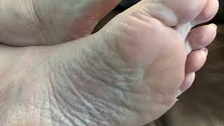 My wifes Sweaty smelly hard skin mature feet