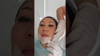 Clinica Ceci Kanno!! Limpeza  pele sem dor, marcas e ainda Rejuvenescimento facial!??