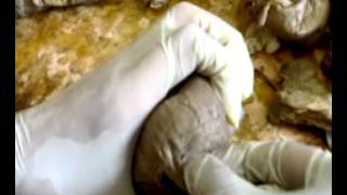 female genital system1