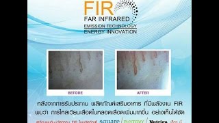 FIR เจาะลึกนวัตกรรมใหม่ของ Successmore โดยนายแพทย์สิทธวีร์