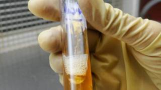 Triple Sugar-Iron Agar Test - Amrita University