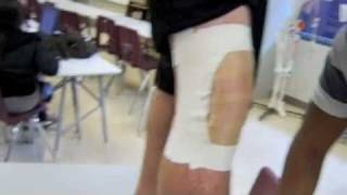 MCL LCL tape job